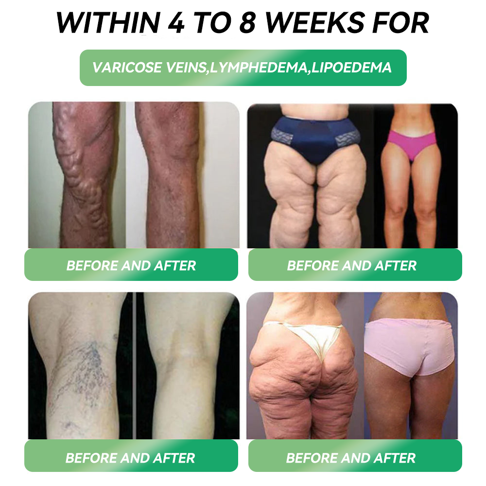 𝑆𝑇𝐷𝐸𝐼® 𝐺𝐿𝑃-1  𝑊𝑒𝑖𝑔ℎ𝑡 𝐿𝑜𝑠𝑠 𝑂𝑟𝑎𝑙 𝑆𝑜𝑙𝑢𝑡𝑖𝑜𝑛 -👨‍⚕️Visible results in 7 days, no side effects, suitable for all age groups💎